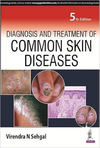 skin diseases treatment