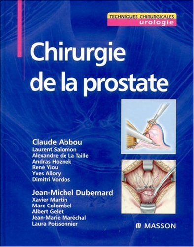 Chirurgie de la prostate