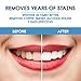 4 Pack Teeth Whitening Pen,Teeth Whitener Gel Kit, Safe and Effective, Travel-Friendly, Painless and No Sensitivity