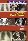 Fundamentals of Chest Radiology