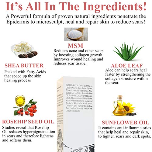 Scar & Bruise Cream Skin Appearance Refining, Surgical, Keloid, C