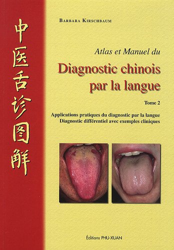 Amazon Fr Atlas Et Manuel Du Diagnostic Chinois Par La Langue Tome 2 Kirschbaum Barbara Baudet Francis Livres Amazon Fr Atlas Et Manuel Du Diagnostic Chinois Par La Langue Tome 2 Kirschbaum Barbara Baudet Francis Livres