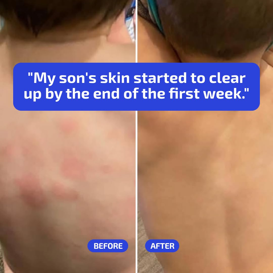 Codex Labs BIA Eczema Relief Lotion, 3.4 oz - Clinically Proven Colloidal Oatmeal 1% for Itchy Dry Eczema Prone Skin - Fragrance Free Moisturizer with BiaComplex 2.0 - Safe for Babies, Kids & Adults