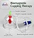 Chinese Cupping Therapy Set,24-Cup Plastic Vacuum Cupping Massage Kit,Magnetic Treatments with Pumping Handle, English Manual for Medical Cupping Massage