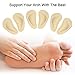 Dr. Foot's Arch Support Shoe Insoles for Flat Feet, Gel Arch Inserts for Plantar Fasciitis, Adhesive Arch Pad for Relieve Pressure and Feet Pain- 3 Pairs (Beige, 3 Count (Pack of 1))