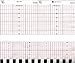 Vermed Medical Chart Paper for Corometrics