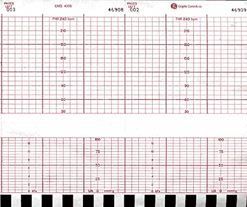 Vermed Medical Chart Paper for Corometrics