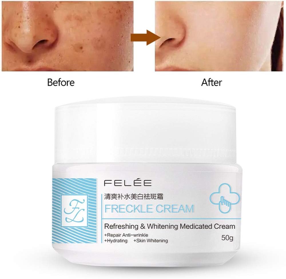 Freckle Removal Whitening Cream Face Moisturizing Brightening Moisturizer Lightening Anti Ageing Anti Aging Women For Hyperpigmentation, Brighten Skin Tone, Dark Spots & Sunspots & Tawny Spots