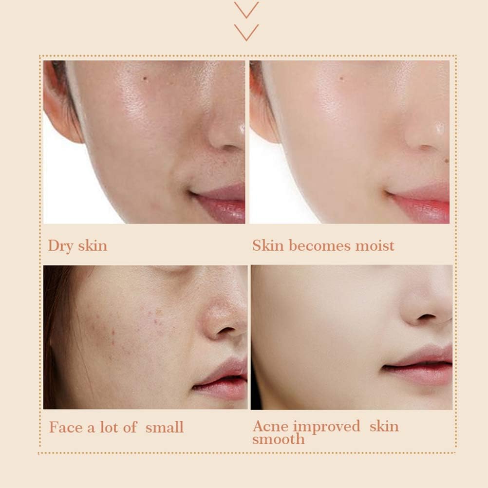 Amazon Supbel 美白クリーム 保湿クリーム 色素沈着 ホワイトニング ブライトクリーム 透明感 補水 そばかす 色素沈着低減 保湿 リフト 引き締め 美白 美肌 美容 引き締め 弾性 毛穴改善 フェイシャルフレーク除去 肌を明るく 顔用 男女兼用 Supbel 乳液 クリーム 通販