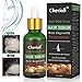 Hair Growth Serum,Hair Loss &Hair Thinning Treatment,Hair Serum,Stimulates New Hair Growth, Promotes Thicker, Fuller and Faster Growing Hair