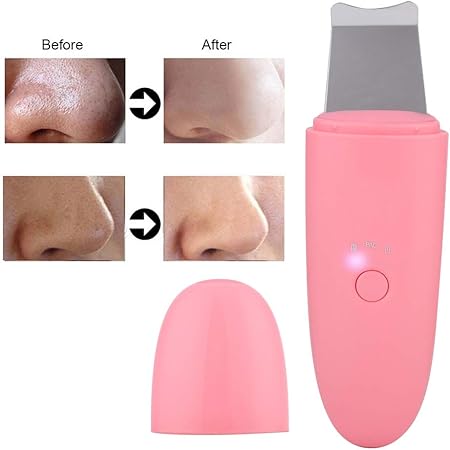 Amazon 効果的に色素沈着を減らし ダークスポットを減らします スキンスクラバーイオンディープクレンジングヘラ黒ずみグリース除去 01 Yuyte 爪切り 通販