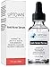 Anti Acne Serum for Men, Women and Teens From Uptown Cosmeceuticals Offers Cutting Edge Skin Care Product that helps to Reduce Acne & Minimize Pores, 30ML
