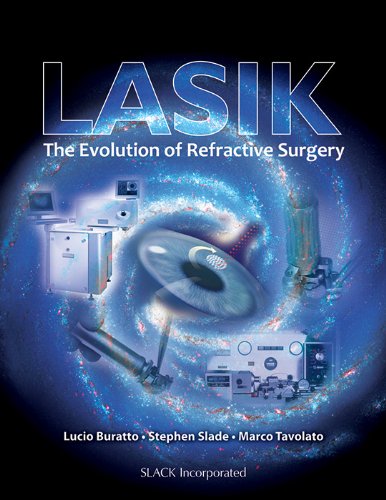 LASIK