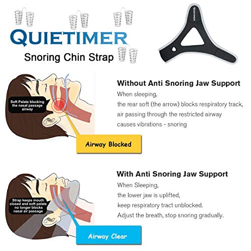 Anti Snoring Chin Strap Snoring Solution, 4 Set Stop Snoring Nose Vent Adjustable Chin Sleep Strap Snore Reduction Snore Relief Chin Strap Sleep Aid Devices Stop Snoring Devices for Men Women