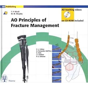 Ao Principles of Fracture Management