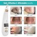 DermaPRO Pore Vacuum Blackhead Remover - Pore Cleanser Vacuum with 6 Extraction Heads - Face Vacuum Pore Cleanser with Dead Sea Mud Mask and Spa Headband