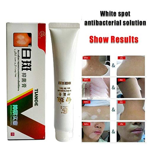 Buy Shoppy Shop Chinese Medical White Spot Disease Cream Pigment