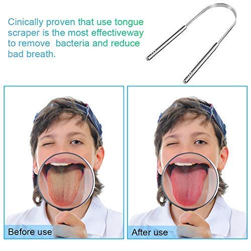 3 Pack Tongue Scraper Cleaner Stainless Steel Fresh Breath Tongue Scrapers Metal Tongue Scraping Cleaner for Oral Care (3Pack-3Color)