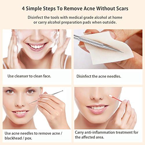 best zit remover