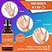 WARTESC Wаrt Remover Liquid Gel, Maximum Strength Removal for Plаntar, Flat, Common Wаrts on Hands, Feet, Fingers, Toes, or Genital Areas, Safe and Effectivethumb 2