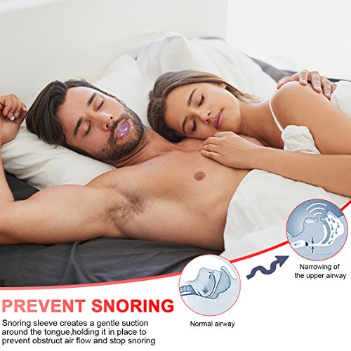 Anti Snoring Devices Snoring Solution, 4 Set Snore Stopper Nose Vents Nasal Dilators Anti Snoring Stop Snoring Solution Anti-Snoring Sleep Aid Device Snore Reduction for Men Women