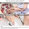 zukabmw-Pedicure-Callus-Shaver-Foot-File-Care-Hard-Skin-Remover-Callus-Shaver-Sets-with-Case-Foot-File-Heads-10-Replacement-Blade-for-Hand-Feet zukabmw Pedicure Callus Shaver Foot File Care Hard Skin Remover Callus Shaver Sets with Case, Foot File Heads & 10…