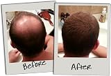 3D Hair Fibres 35g Medium Brown Keratin Protein for Thinning Hair Men Women view 6