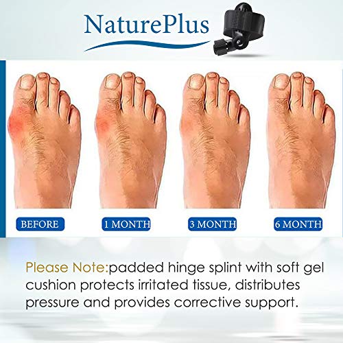 Bunion Corrector Splints Foot Care Corrector Thumb Brace for Tailors Bunion and Hallux Valgus Big Bone Orthotics Toe Separators - Thumbnail 3