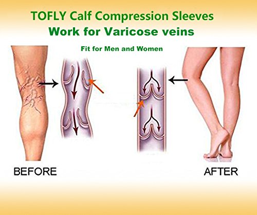 6 Calf+Compression+Sleeve+Pair+20+30mmHg