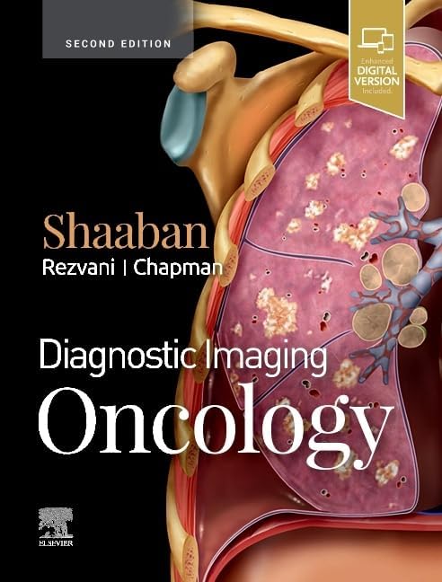 DIAGNOSTIC IMAGING CHEST 2nd Edition 胸部 Diagnostic Imaging: Chest: 9780323796637: Medicine & Health