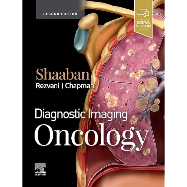 裁断済 Diagnostic Imaging: Musculoskeletal Diagnostic Imaging: Musculoskeletal Trauma: 9780323392532