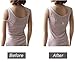 Women's 3 PACK Non Slip Elastic Bra Strap Clips Holder - Adjustable & Concealing
