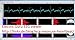 Shield-EKG-EMG-PRO Cable for Gel ECG Electrodes