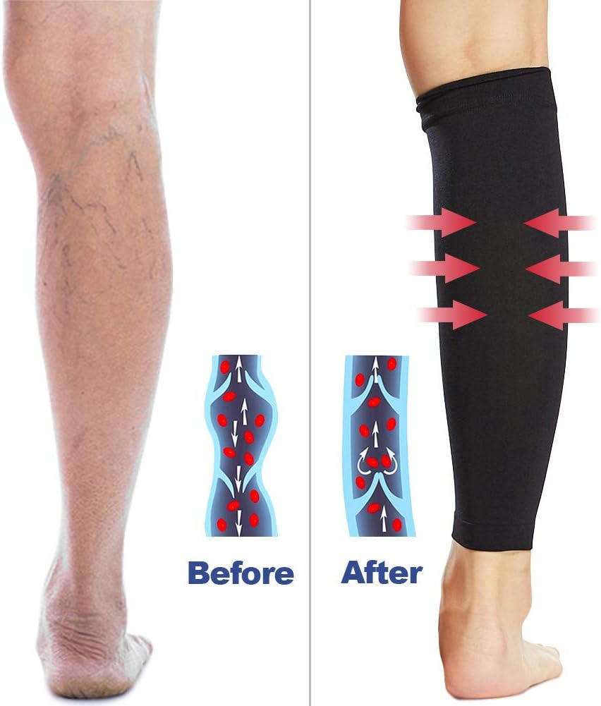 Beister 1 Pair Compression Calf Sleeves (20-30mmHg), Perfect Compression Socks for Running Shin Splint, Medical, Pain Relief - Image 5