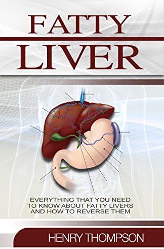 Fatty Liver: The Ultimate Step-by-Step Guide To Understanding and Reversing Fatty Liver Disease (Liver Cleanse, Nutrition, Liver Cleanse, Healthy Living, Revitalise Health, Detox Body, Weight)