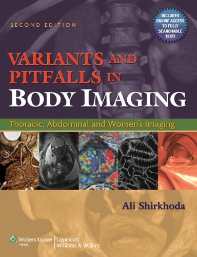 [F.r.e.e] Variants and Pitfalls in Body Imaging: Thoracic, Abdominal and Women's Imaging D.O.C