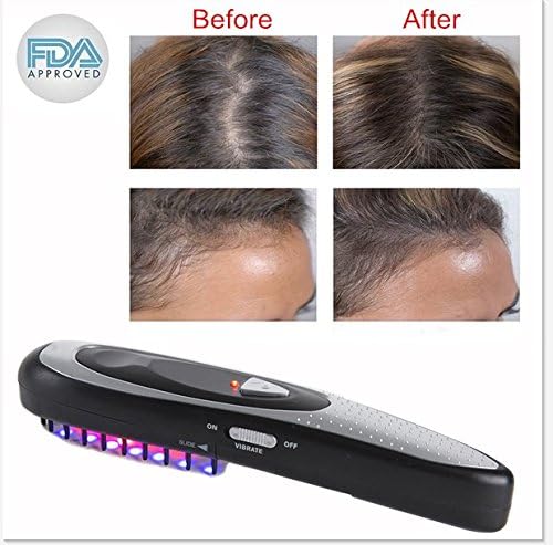 Electric Hair Regrowth Styling Brush HUBEE Strengthens Hair Roots Grow,Anti Hair Loss Comb (A01)