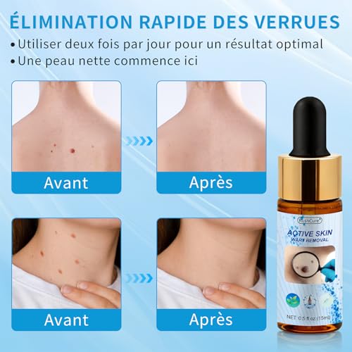Action Removal of Skin Tags – Precision Face & Body Pipette | Targeted Removal of Plantar, Vulgar and Flat Warts | Soft Formula, Travel Size (15 ml)