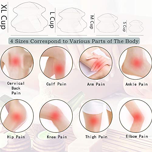 4 Sizes Cupping Therapy Set-Professional Cupping Therapy Studio and Household Silicone Cupping Set, Stronger Suction… - Image 2