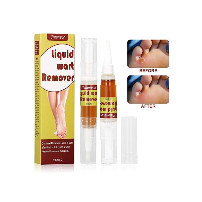 Wart Remover, Plantar Wart Remover, Wart Removal, Corn Remover, Wart Removal Pen with Natural Ingredients, Penetrates…