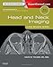 Head and Neck Imaging: Case Review Series
