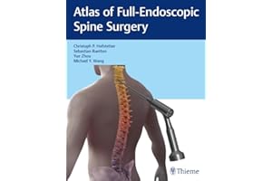 Atlas of Full-Endoscopic Spine Surgery