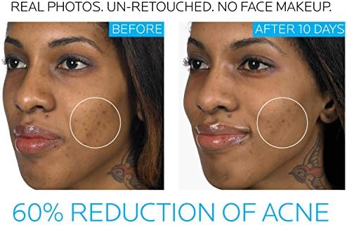 effaclar benzoyl peroxide