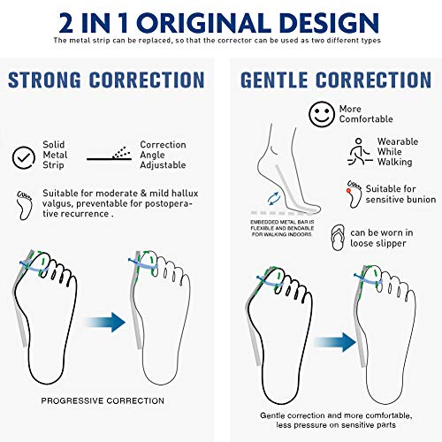2 in 1 Bunion Corrector | Orthopedic Big Toe Straightener | Bunion Relief | 100% Adjustable Bunion Splint | Strong and Gentle Correction | Original Design (1 Pair Splints)