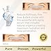 Organic Anti-Aging Eye Serum a Refined Eye Cream for Dark Circles Wrinkles Puffiness Fine Lines by AgeVex : Natural Ingredients w/Hyaluronic Acid & Peptides to Stimulate Collagen & Skin Cells