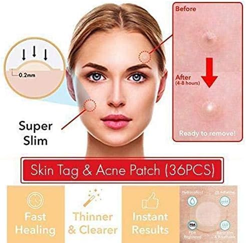Oseno THE MAGIC SKIN PATCH - 24Pcs Skin Tag Removal Patch Blackhead Blemish Removers
