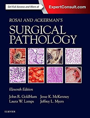 Diagnostic Histopathology of Tumors, 2 Volume Set: Expert Consult