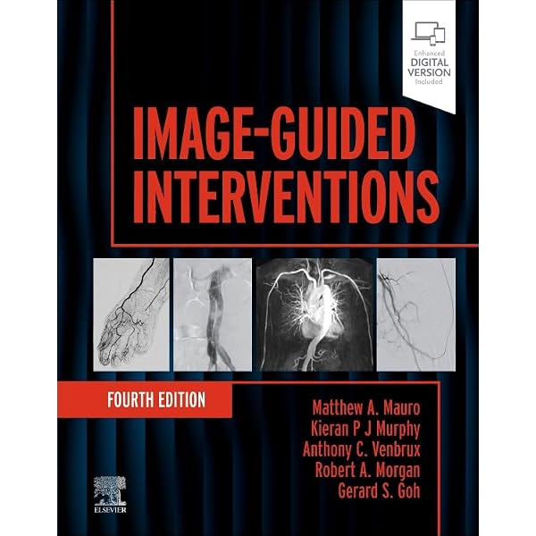 Image-Guided Interventions: Expert Radiology Series: 9780323612043