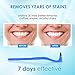 BabyNora Tooth Stain Remover, Dental Plaque Tool, Dental Calculus Plaque Cleaning Eraser Plaque Remover for Fighting Tartar Teeth Stains Teeth Polishing