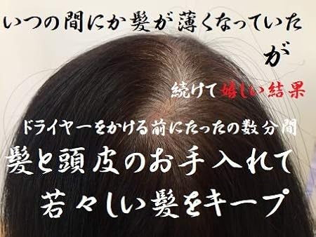 Amazon テキスト 薄毛は頭皮の血行不良や乾燥 女性ホルモンの減少の為 シャンプーついでの 頭皮aromaマッサージ を続ける人に 実践aromaマッサージオイルキット50 1本付き アロマレメディー マッサージ アロマ